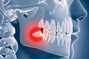 15 Cirugía maxilofacial copia