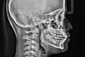 2 Radiografías Cefalométricas copia