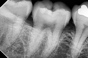 3 Radiografía dental copia